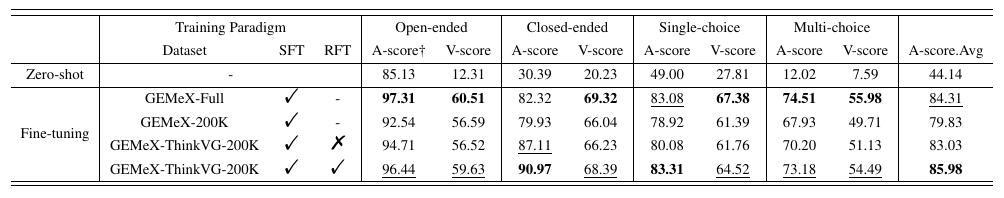 ThinkVG supervised and reinforcement fine-tuning results